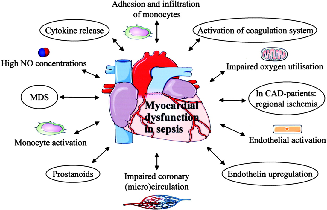 septisk kardiomyopati