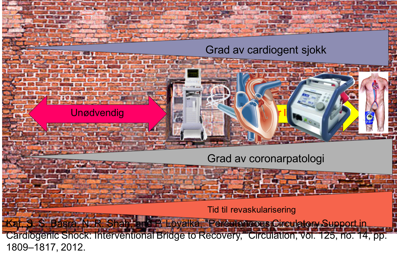 sirkulatorisk assist vindu